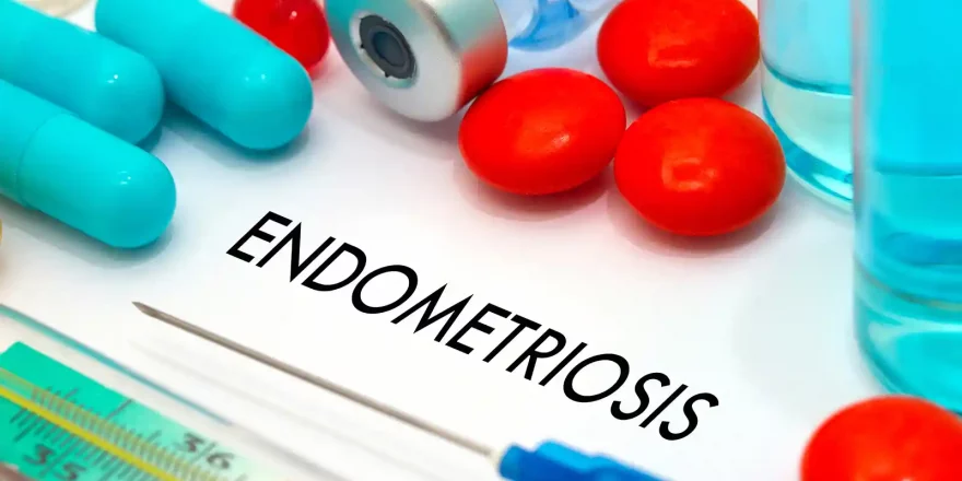 Endometriosis-Treatments